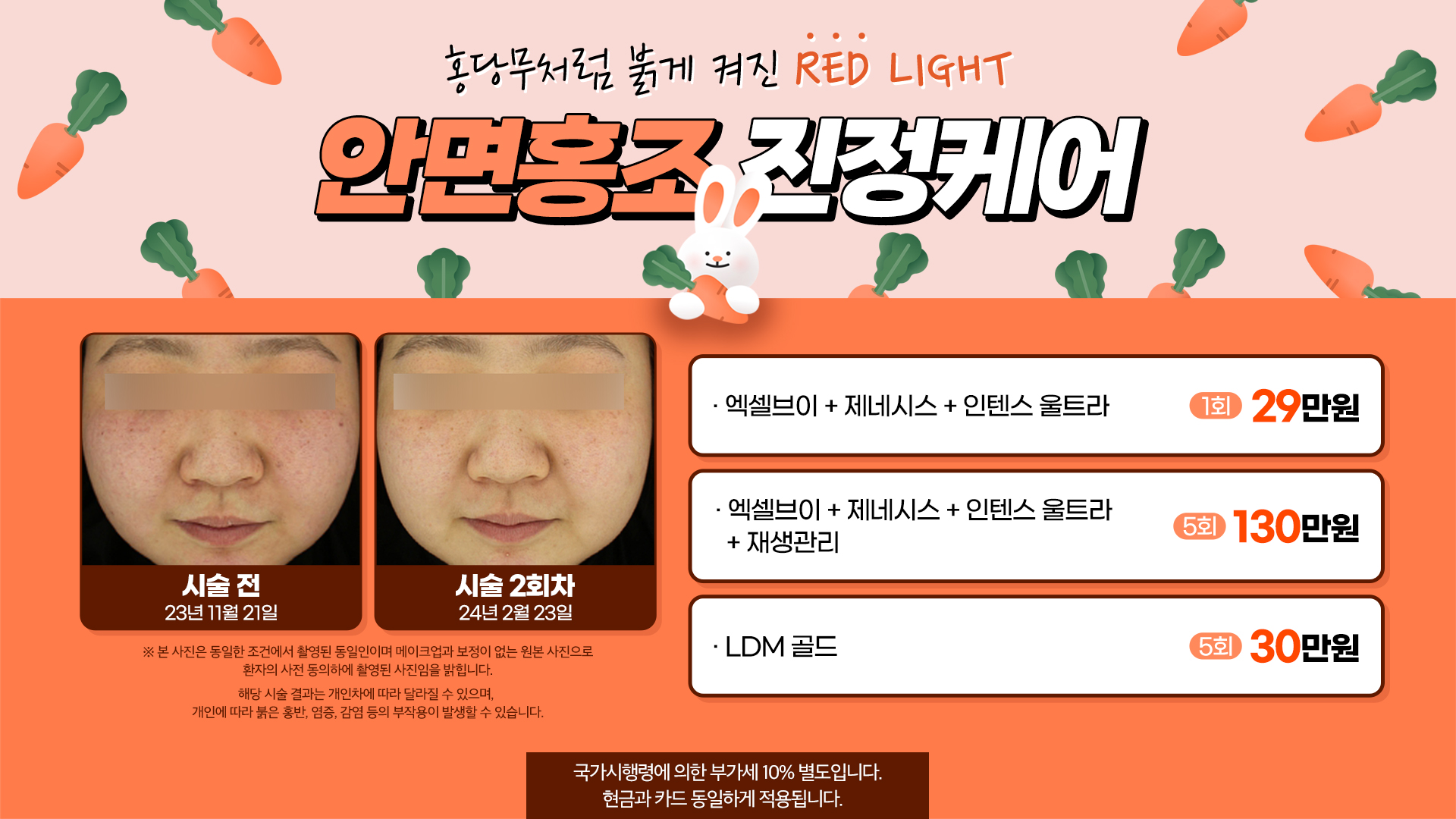 안면홍조 진정케어
