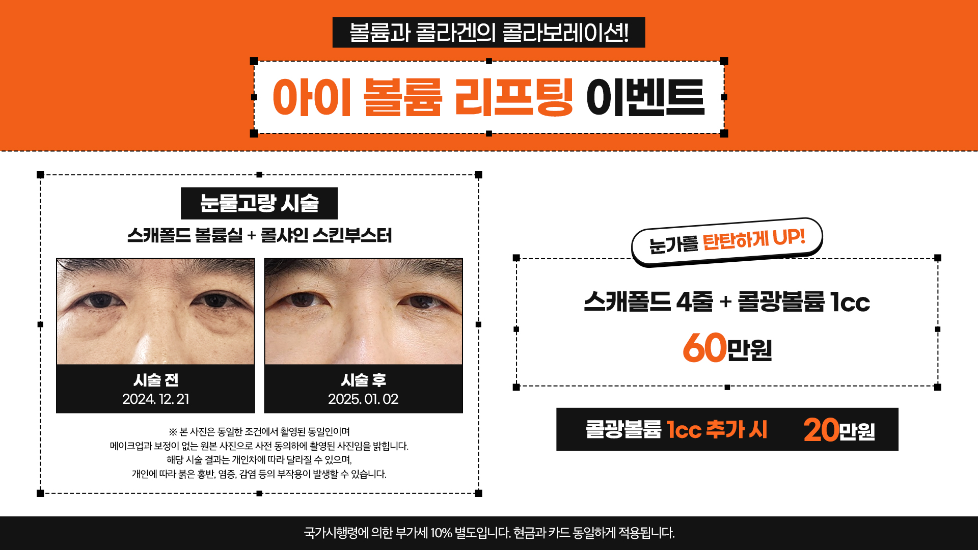 아이볼륨 리프팅 이벤트