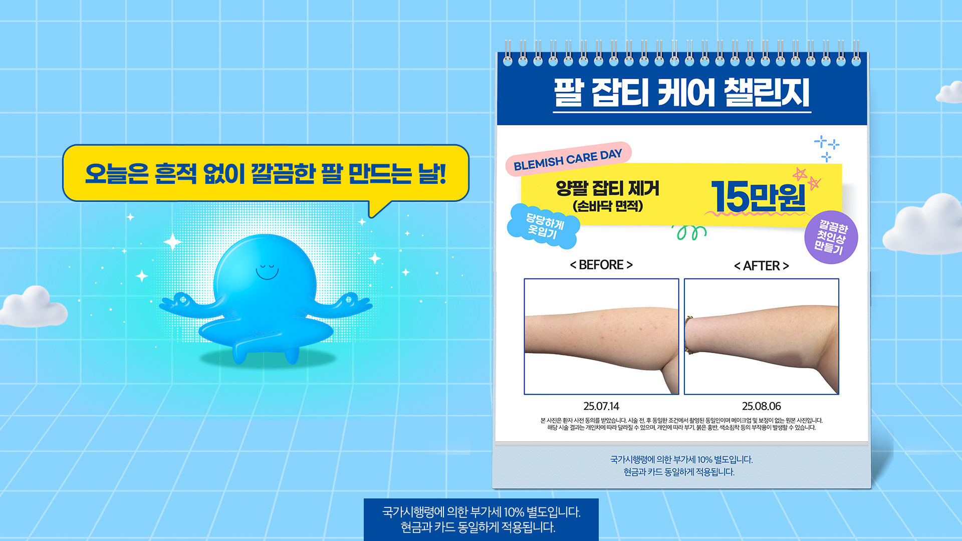 팔 잡티 제거 챌린지